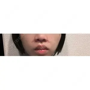 口コミ