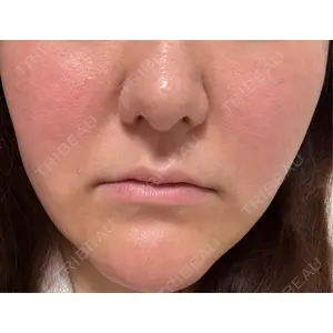 X CLINIC 恵比寿院口コミ