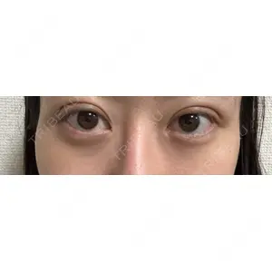口コミ