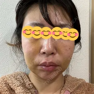 口コミ