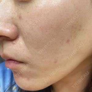 CZEN CLINIC 銀座院口コミ