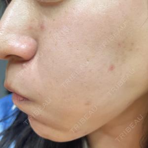 CZEN CLINIC 銀座院口コミ