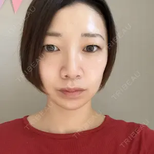 Re:anne clinic 銀座 【リアンクリニック銀座】口コミ