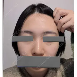 LUHO（ルホ）美容外科口コミ