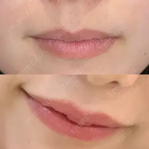 ルラ美容クリニック 上野院口コミ