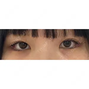口コミ