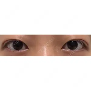 オアシス美容外科口コミ