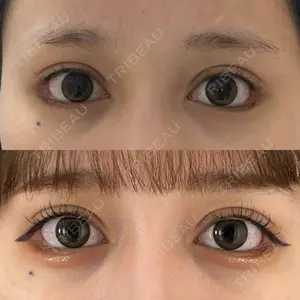 HAAB×DREAM BEAUTY CLINIC HAAB×DREAM BEAUTY CLINIC 大阪梅田院口コミ