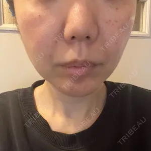 筋肉・美容クリニック口コミ