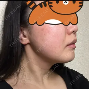 口コミ