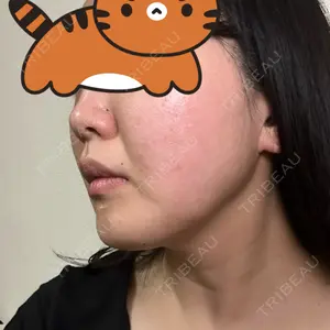 口コミ