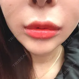 R Beauty CLINIC R Beauty CLINIC 銀座院口コミ