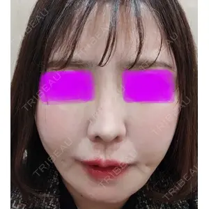 A CLINIC（エークリニック） A CLINIC（エークリニック） 新宿院口コミ