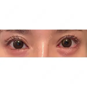 口コミ