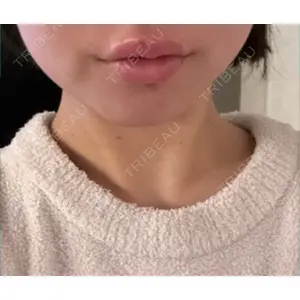 口コミ