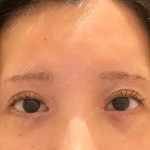 ノエル銀座クリニック口コミ