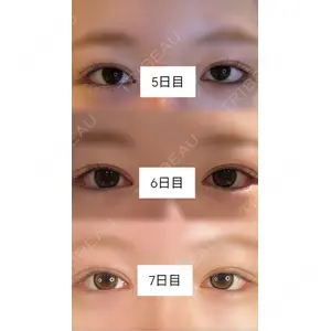 口コミ
