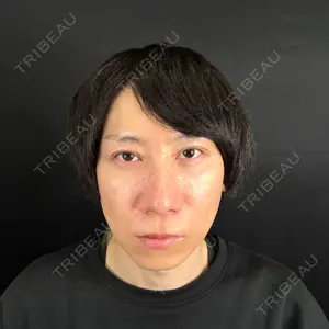 藤・ナチュレ美容クリニック 藤・ナチュレ美容クリニック 銀座院口コミ