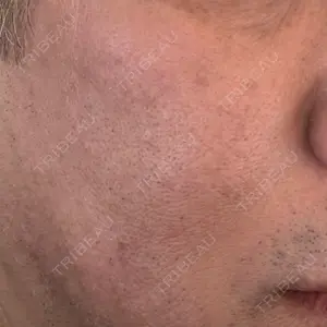 Re:anne clinic 銀座 【リアンクリニック銀座】口コミ