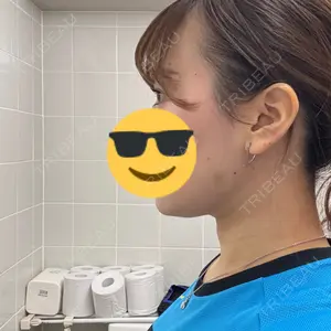 TCB東京中央美容外科 TCB東京中央美容外科 池袋駅前院口コミ