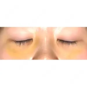 APOLLO BEAUTY CLINIC口コミ
