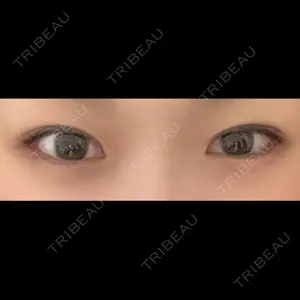 LUHO（ルホ）美容外科口コミ
