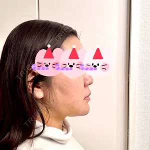 口コミ