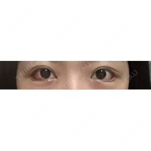 HAAB×DREAM BEAUTY CLINIC HAAB×DREAM BEAUTY CLINIC 大阪梅田院口コミ