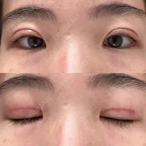 東京BELLEZZAクリニック口コミ