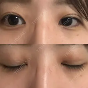 口コミ