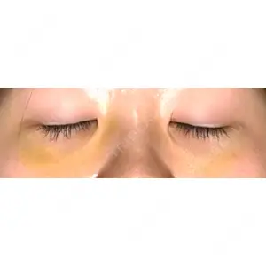 APOLLO BEAUTY CLINIC口コミ