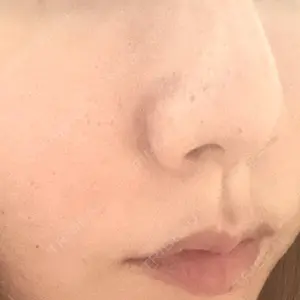 口コミ