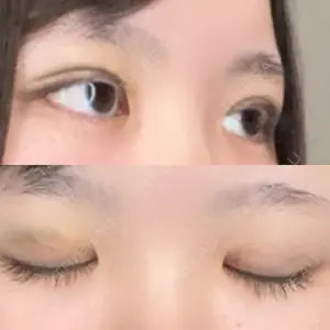 口コミ