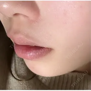 口コミ