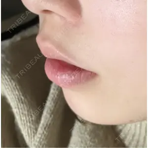 口コミ