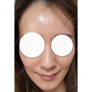 心斎橋KT美容クリニック口コミ