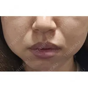 DMTC美容皮膚科 DMTC美容皮膚科 渋谷院口コミ