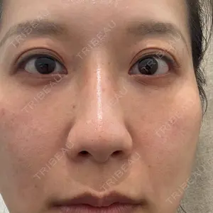 湘南美容クリニック 池袋東口院口コミ