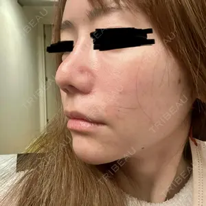 ASTRA BEAUTY CLINIC口コミ