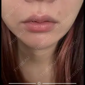 藤・ナチュレ美容クリニック 銀座院の