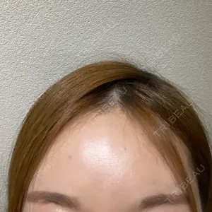 TCB東京中央美容外科 TCB東京中央美容外科 名古屋栄院口コミ