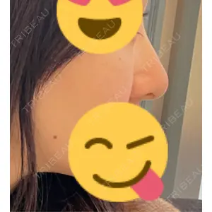 BIANCA CLINIC BIANCA表参道口コミ