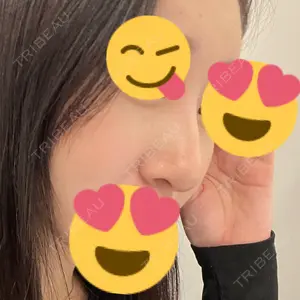 BIANCA CLINIC BIANCA表参道口コミ