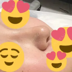 BIANCA CLINIC BIANCA表参道口コミ