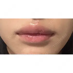 渋谷美容外科クリニック 渋谷美容外科クリニック 新橋院口コミ