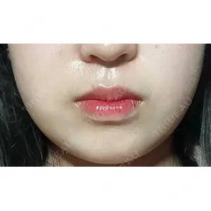 A CLINIC（エークリニック） 新宿院の