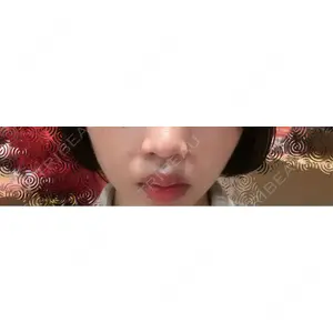 口コミ