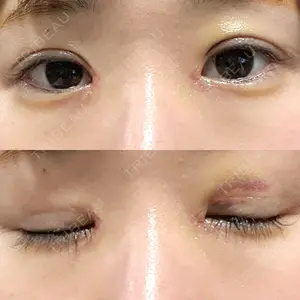 東京シンデレラ美容外科 東京シンデレラ美容外科 池袋院口コミ