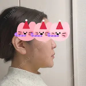 口コミ