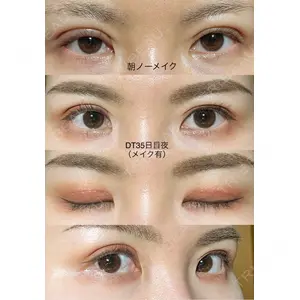 BIANCA CLINIC BIANCA銀座口コミ